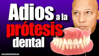 LA MEJOR FORMA de REEMPLAZAR TU PROTESIS DENTAL sin TENER MUCHO HUESO en las ENCÍAS