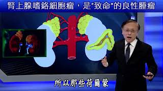 腎上腺嗜鉻細胞瘤，是"致命"的良性腫瘤 Pheochromocytomas are "fatal" benign tumors.【大愛醫生館精選】