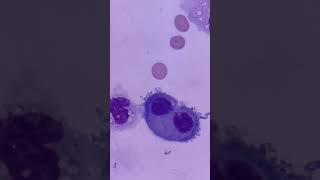 Mesothelial cells dividing. #foryou #biology #medicallab #science #shorts #medtech #medtechstudent