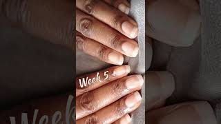 HOW TO GROW LONG NAILS WEEK 5 PROGRESS #NAILS #nailgrowth #SHORTSFEED