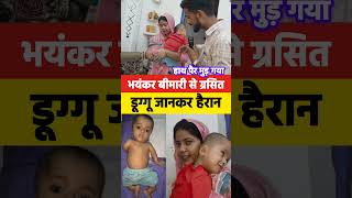 Duggu is suffering from a serious disease | #viralvideo #duggugautam #viralpost2025シ