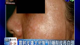 愛美打雷射長白斑 竟是皮膚癌