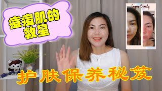 痘痘肌必看，如何摆脱痘痘肌，抗痘方法和正确护理保养。