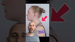 How To Get Rid Of Your Neck Hump!