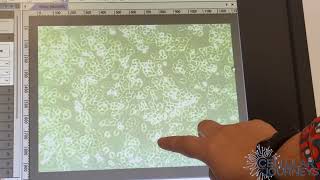 Making Observations of Cells Post Treatment