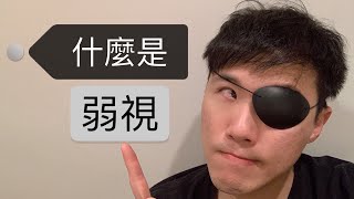 什麼是弱視 lazy eye (amblyopia)？分哪幾種?