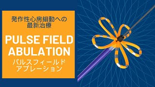 発作性心房細動への最新治療「パルスフィールドアブレーション」