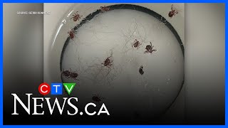 Camper covered in ticks after hike in Alberta provincial park