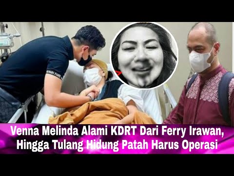 Hari ini| Sangat Sadis,Tulang Hidung Venna Melinda Patah Hingga Harus Operasi,KDRT Dari Ferry Irawan