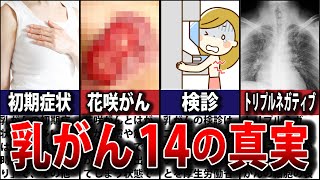 乳がんの質問にすべて答えます【初期症状/完治/早期発見/費用/末期/検診/しこり/花咲乳がん/治療/余命/完治/トリプルネガティブ】