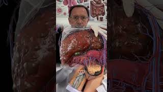One Simple Morning Habit That Saved My Patients Liver! #livercare