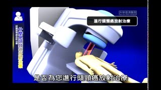 【知情同意】認識頭頸部癌症放射治療-台語版