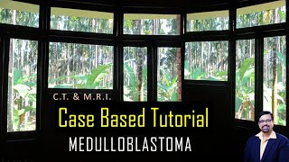 MEDULLOBLASTOMA  - A CASE BASED TUTORIAL ( C.T & M.R.I ) .