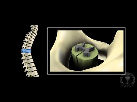 الجهاز العصبي: النخاع الشوكي