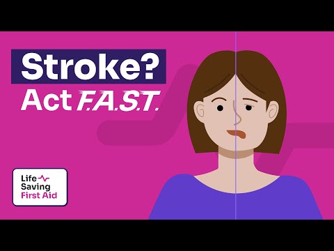 Stroke Signs and Symptoms - How to Recognize a Stroke and Save a Life FAST!