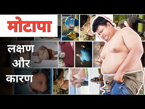 मोटापा होने का कारण 🤔 | मोटापा दूर कैसे करे ! | How to burn Fat।fat loss kaise
