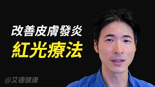每週照光2次「體重減3%」　眼睛清晰度↑30%！還可以加速傷口癒合！｜ 艾德健康