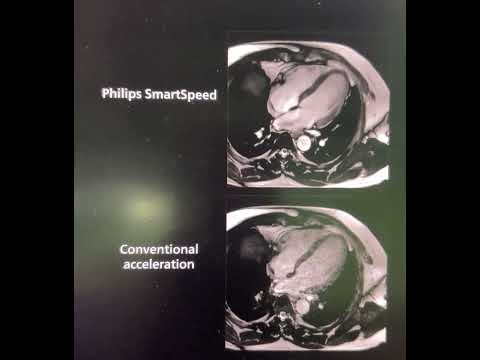 #award #winning #philips #Smartspeed #fastest #MRimaging