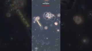 New Desease nagleria flowri #desease #harmful