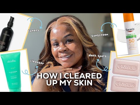 products you NEED to buy to FINALLY get rid of your acne !