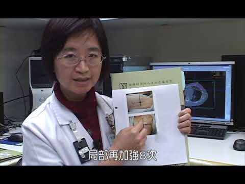 10-6.乳癌衛教影片 06 問與答