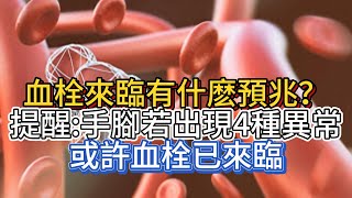 血栓來臨有什麽預兆？提醒：手腳若出現4種異常，或許血栓已來臨