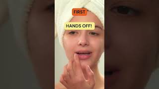 5 Tips for Aftercare of Lip Fillers Injections