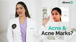 The Derma Co |  Sali-Cinamide Serum for Acne & Acne Marks