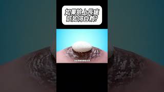 如果臉上長痣，該如何自救?#科普 #漲知識