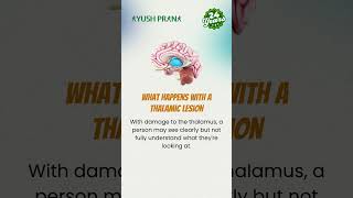 The Connection Of Central Nervous System and Vision By Dr. Prasanth