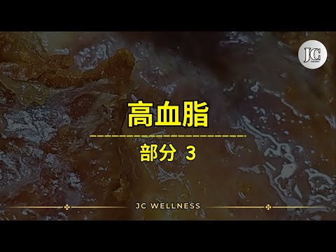 可能在中风的边界了丨高血脂丨部分 3丨有哪些人容易得高血脂症丨如何防治高血脂症丨三高丨心脏病丨油腻食物丨暴饮暴食丨中风的边界丨JC WELLNESS
