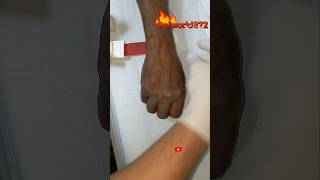 IV cannulation #aiworld872 @Aiworld872 #ivcannulation #ivinsertion #hospital #foryou
