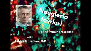 Naegleria fowleri & the host immune response
