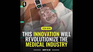 SurgicalAR  credit: Medivis #ai #aitool #aitools #aitech #mrscan #ctscan #aidoctor #arsurgeons