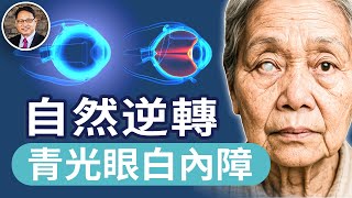 白內障、青光眼不用手術？自然逆轉？兩位患者的親身見證與科學整合方法｜四維健康