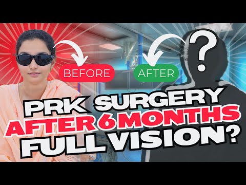 My Eyes and Vision, 6 Months After PRK Eye Surgery | SumiiTalks