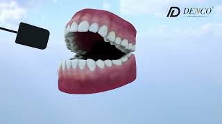 Dental Digital Sensor