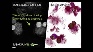 The perfect murder - Macrophage cell killed by T-cells