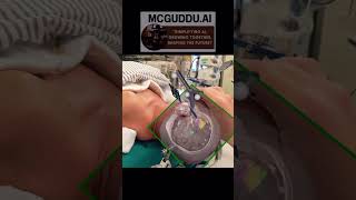 Tractography In Real-time 🤯 #surgicalar #aisurgery #surgerytips #neuroscience #neurotechnology