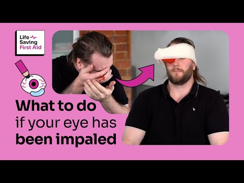 Impaled Object in Your Eye | First Aid Emergency Guide