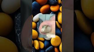 #toenails #ingrowntoenail #toenailremoval #nails #toenail #satisfyingvideo  #satisfying