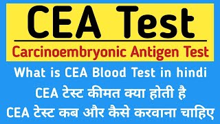 CEA Test in hindi | Carcinoembryonic Antigen Test in hindi | Price, Symptoms & Normal Range