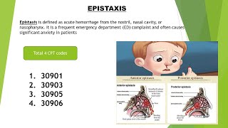 Epistaxis (Nosebleed) CPT Coding | ED & Surgery Coding | Medical coding | ICD & CPT Assign codes.