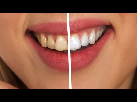 How to Whiten teeth at home without baking soda - Dentitox Review