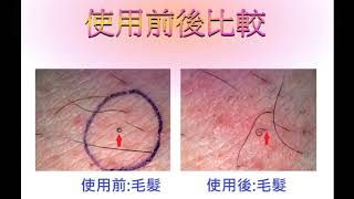 毛孔阻塞救星、剋內生毛髮保養液實測(1)+除毛前後保養必備