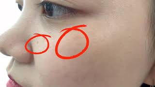 中国有纯韩式皮肤管理吗？亲测体验济南江南枫然皮肤管理中心，快来围观！