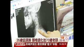 【中視新聞】35歲低頭族 頸椎退化如70歲老頭 20141021