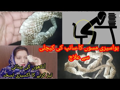 أنکھوں کی بینائی اور بواسیری مسوں کا سانپ کی کینچلی سے علاج🐍Snake ShedWeakEyeSight,pilesTreatment