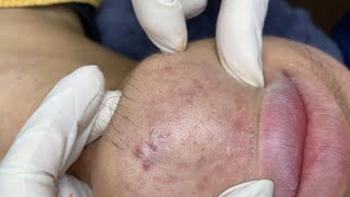 Satisfying Relaxing #ThuyTruong656