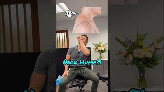 Fix neck hump with this amazing neck stretcher. #neckhump #dowagershump #posture